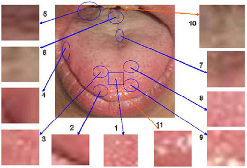 pic 2.The Analyzed map of tongue on computer
