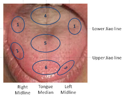 pic 3.Areas for analyzing the tongue: (1) Kidney waist — no strength; (2) Liver rib area — fullness; (3) Energy stagnation in the Heart; (4) Mingmen area — no energy; (5) Weak spleen and stomach; (6) Lower dispersion function of the lung