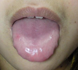 Large and soft tongue